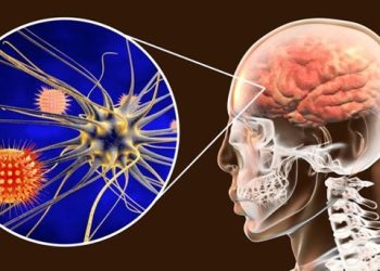 Meningitis: prevención y retos para México