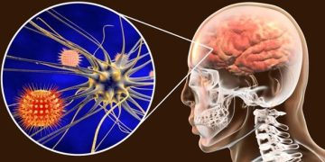 Meningitis: prevención y retos para México